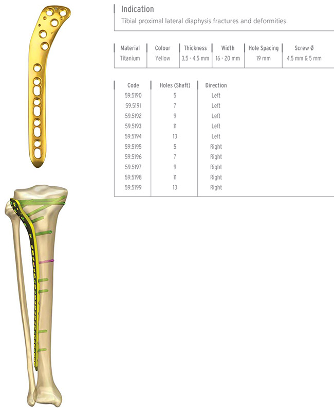 Unilock Tibia Proximal Lateral Plate